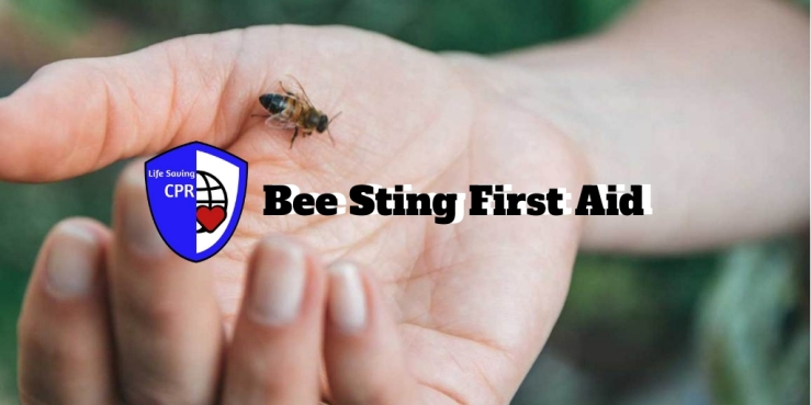 Bee Sting First Aid